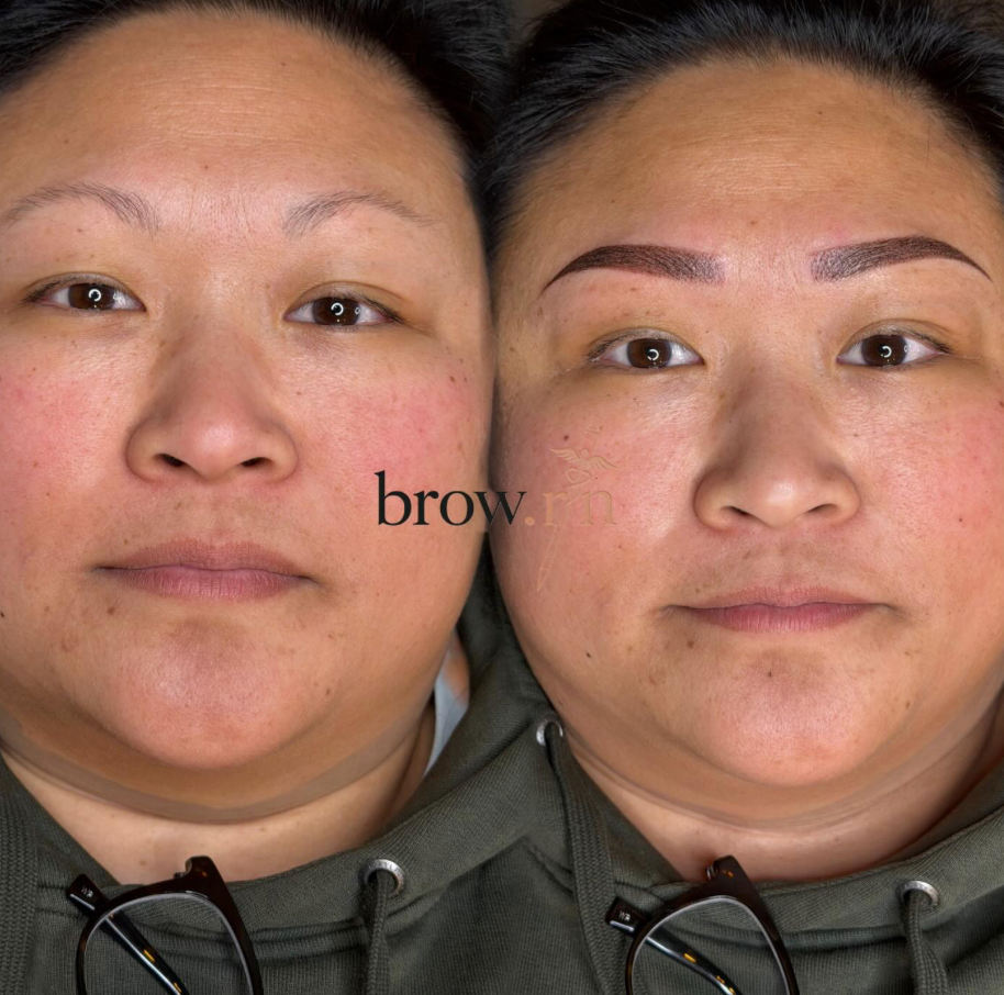 Original before-and-after collage for Brow.RN brow study 01